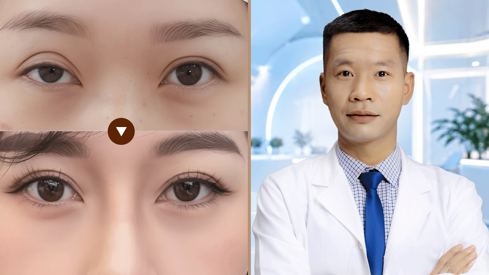 Sửa mí lỗi hỏng
