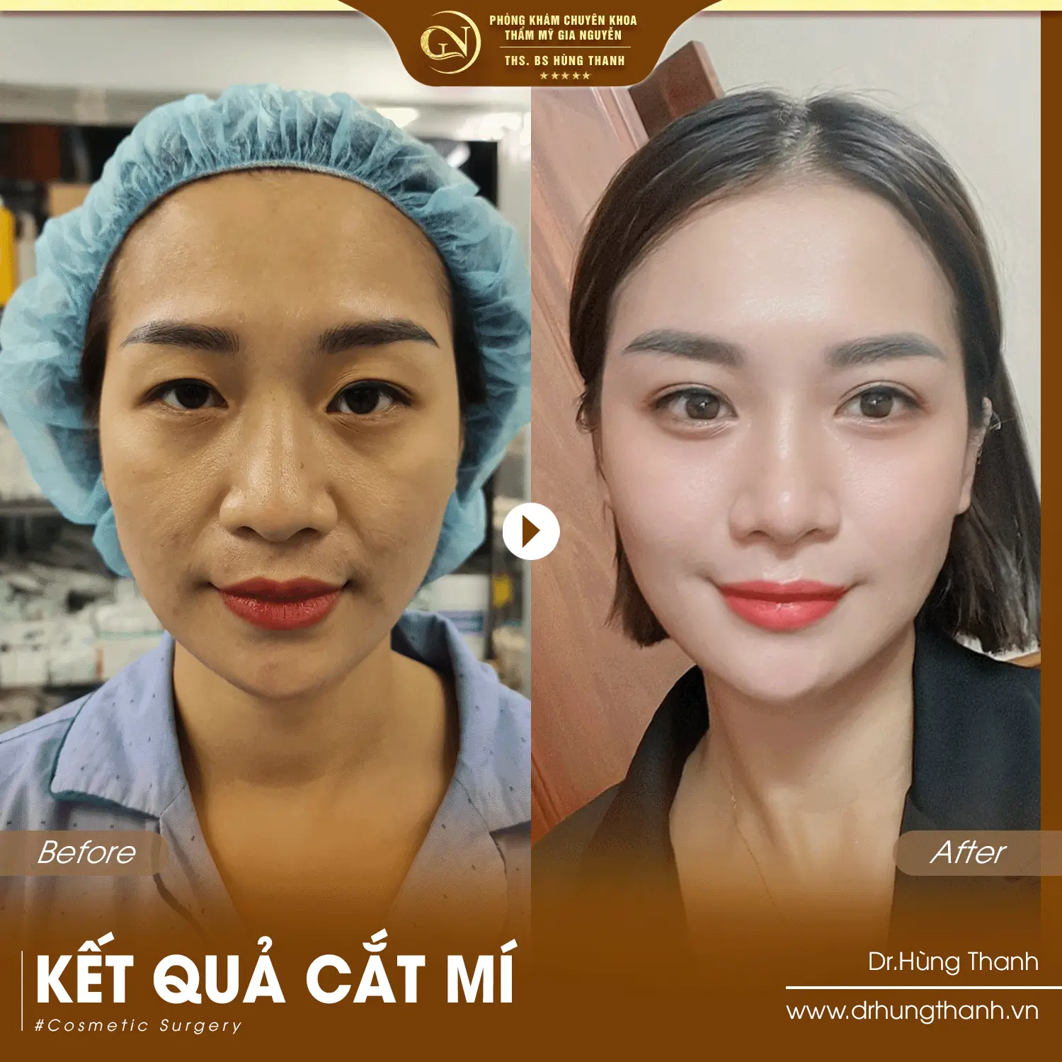 Khách hàng 4
