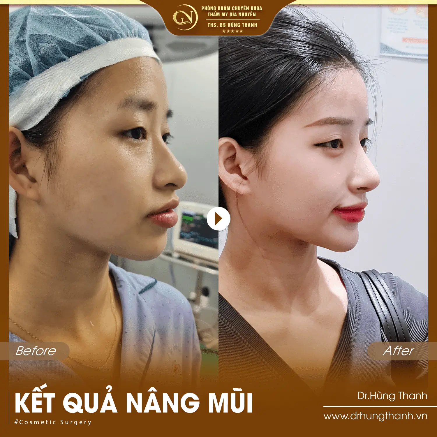Khách hàng 1