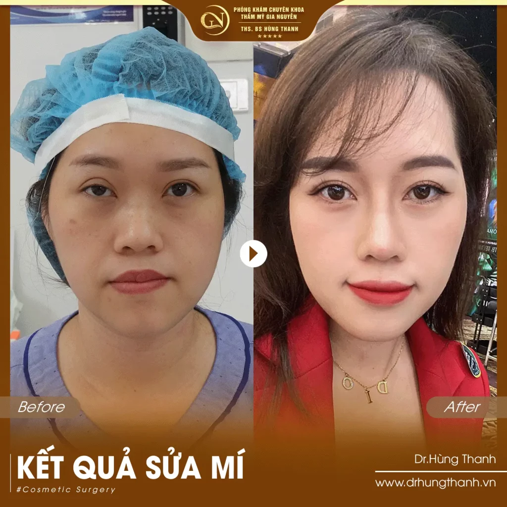 Khách hàng sửa mí